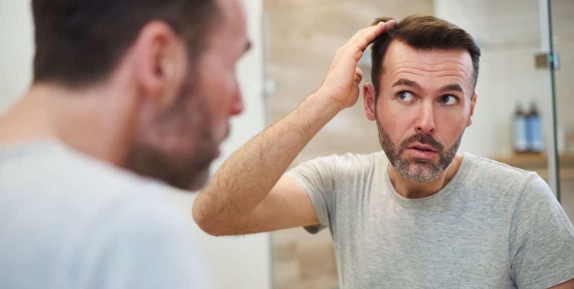 Hair loss Q Dermatology