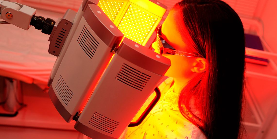 Photodynamic Therapy (PDT) | Q Dermatology